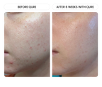 All-In-One Face Serum